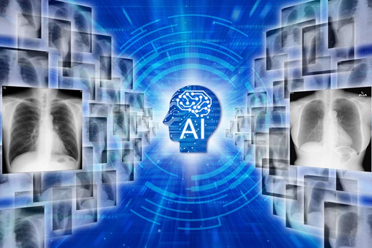 専門医とAI技術を活用した胸部画像診断
