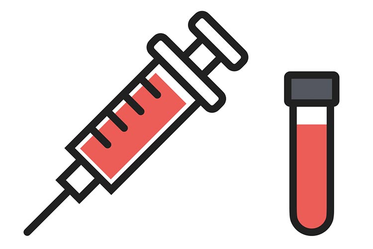 血液検査のイメージ