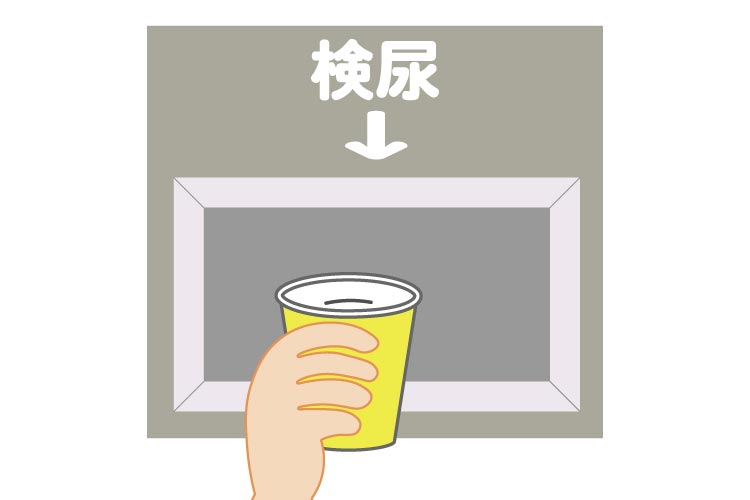 尿検査のイメージ