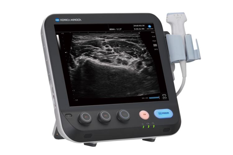 超音波検査のイメージ